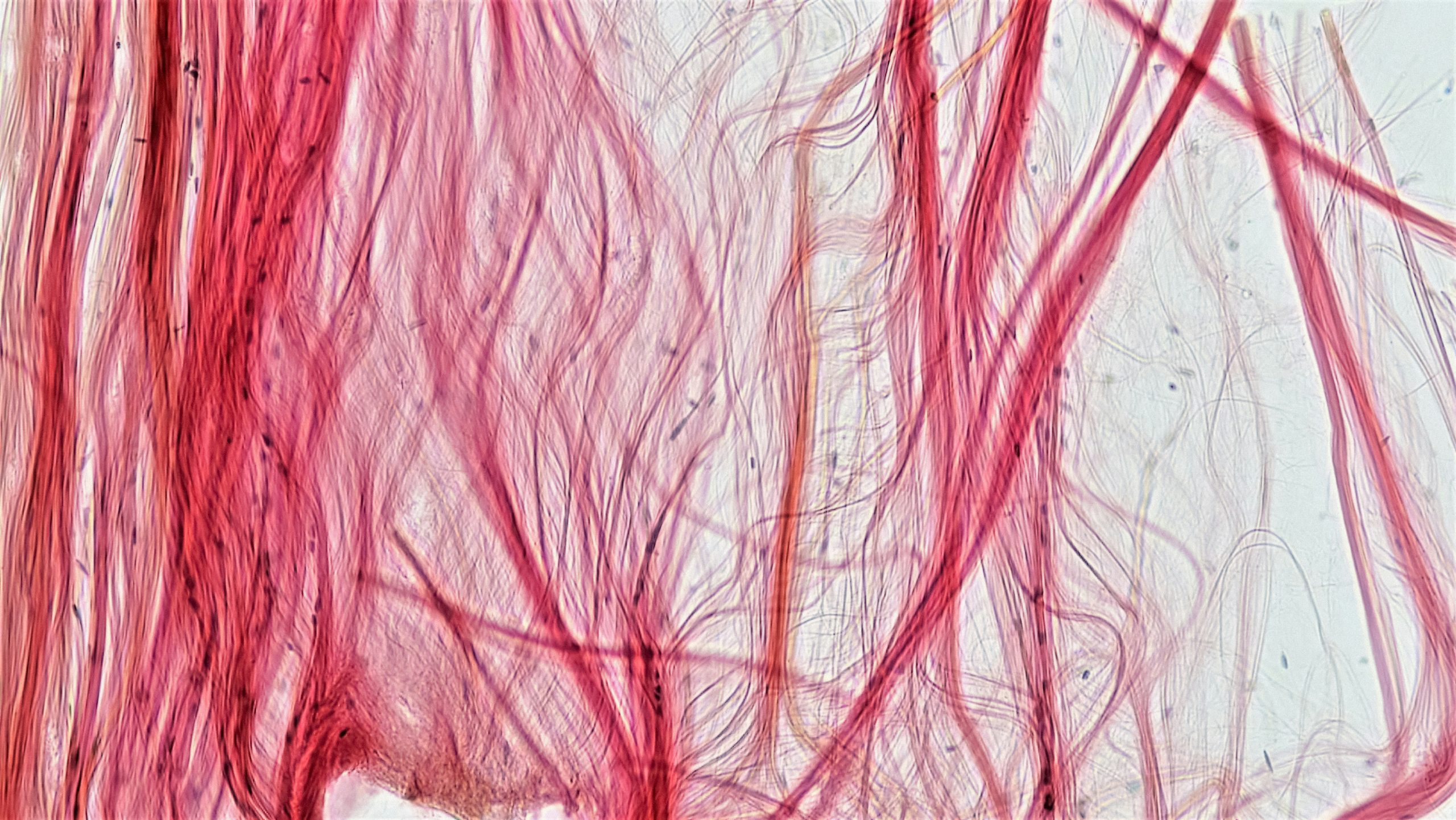 bioscience-image-library-by-fayette-reynolds-tendon-magnification-100x Tendon tissue teased and magnified 100 times.